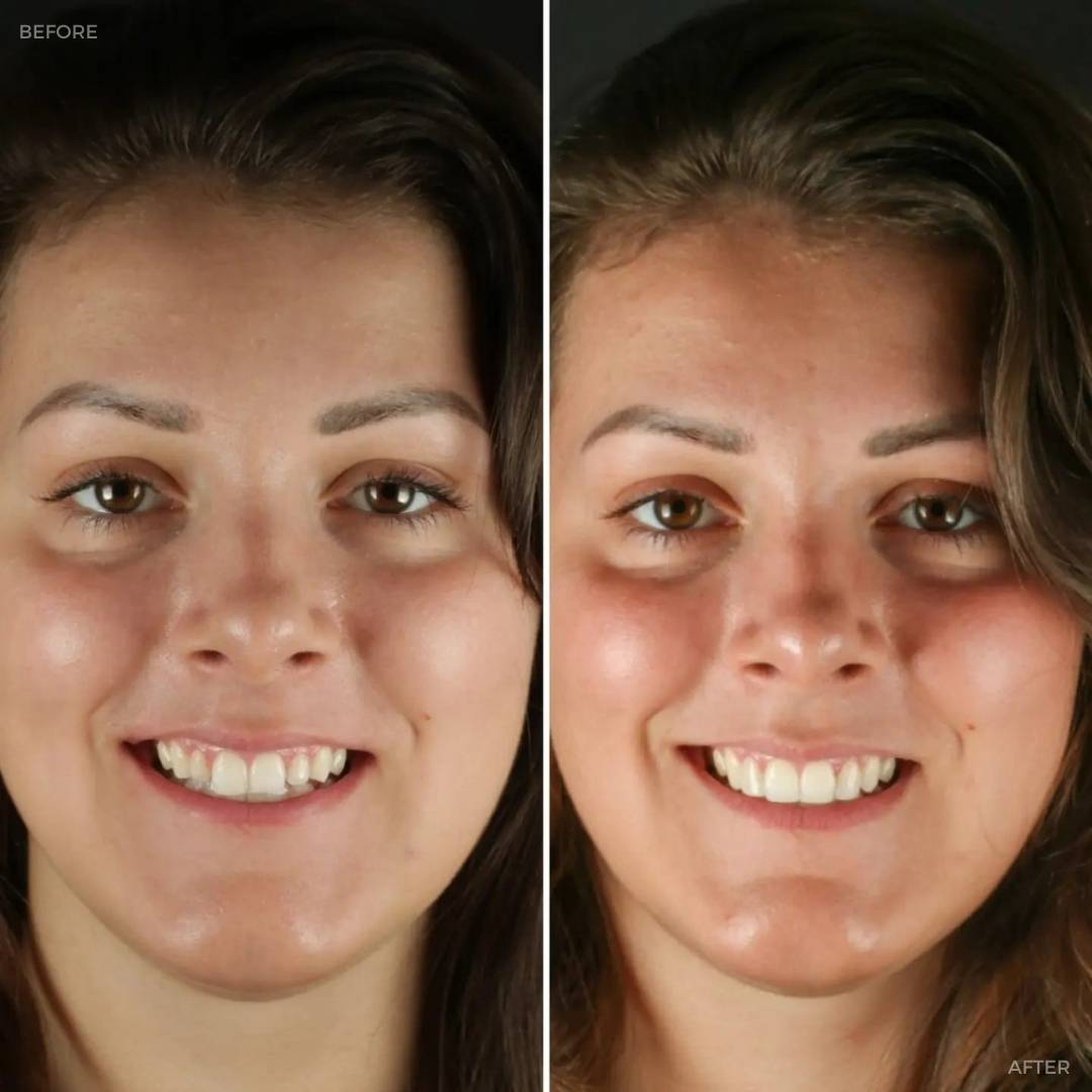 Before and after treatment