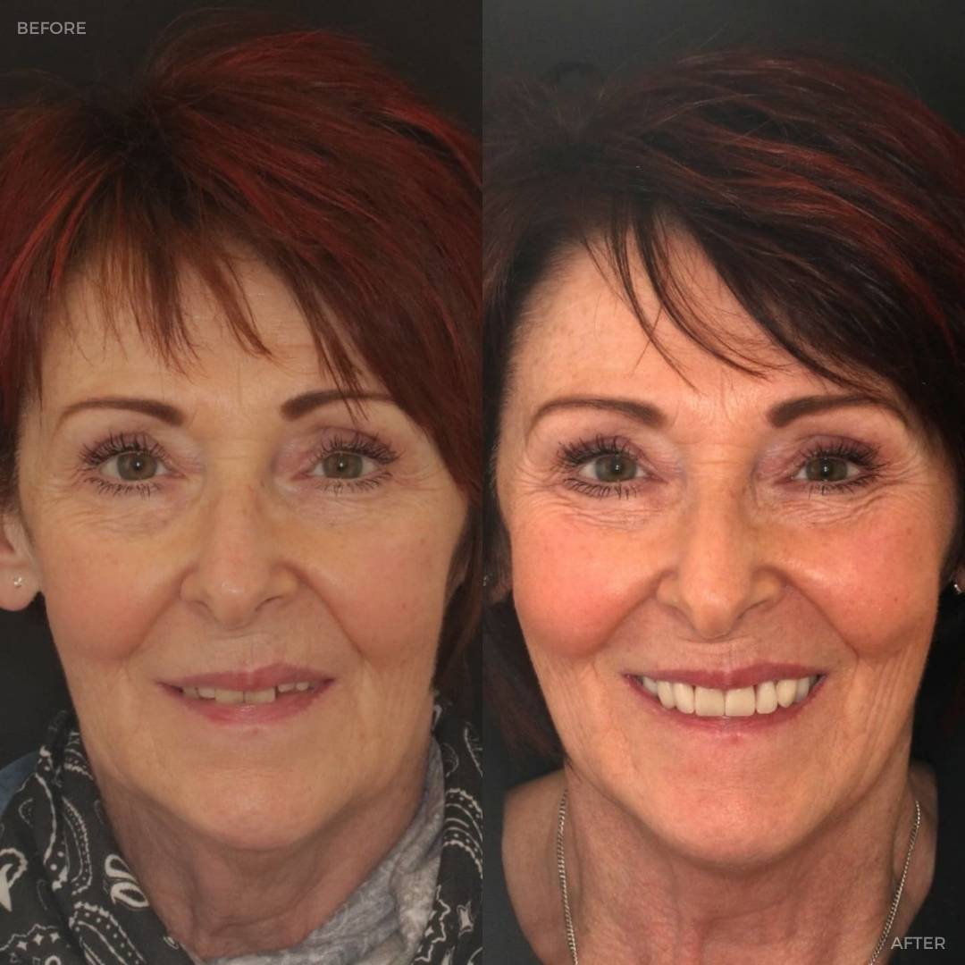 Before and after treatment