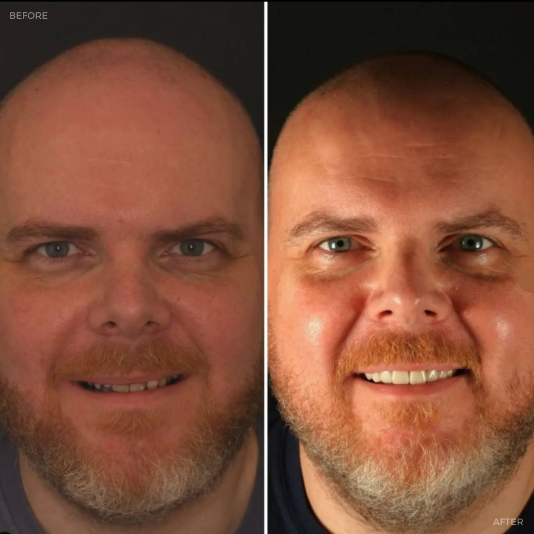 Before and after treatment