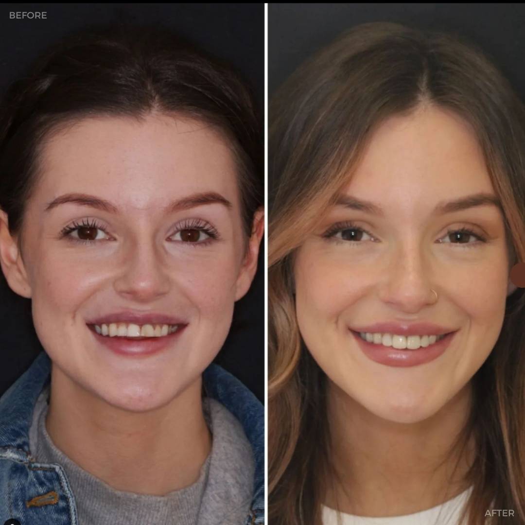 Before and after treatment