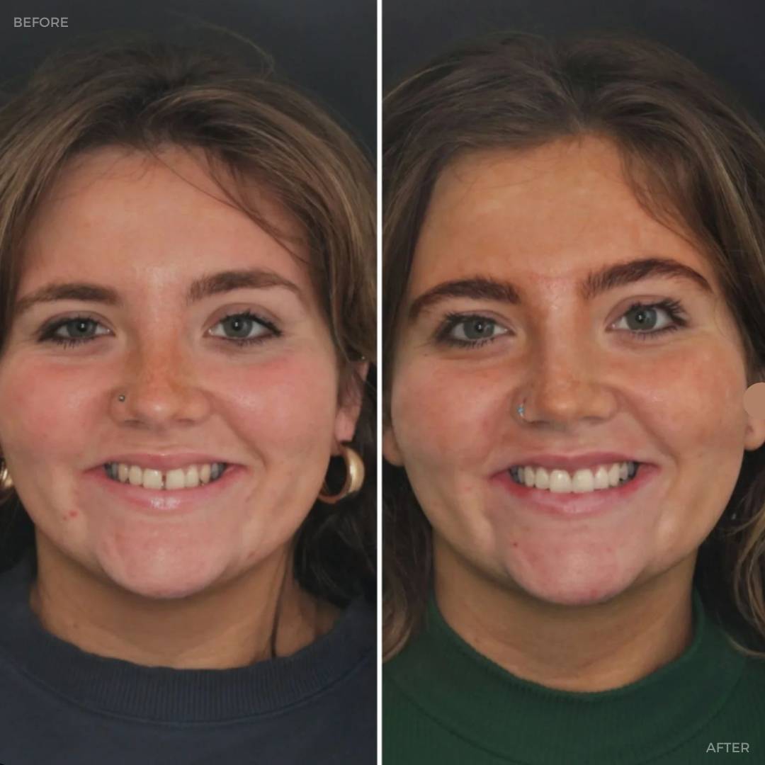 Before and after treatment