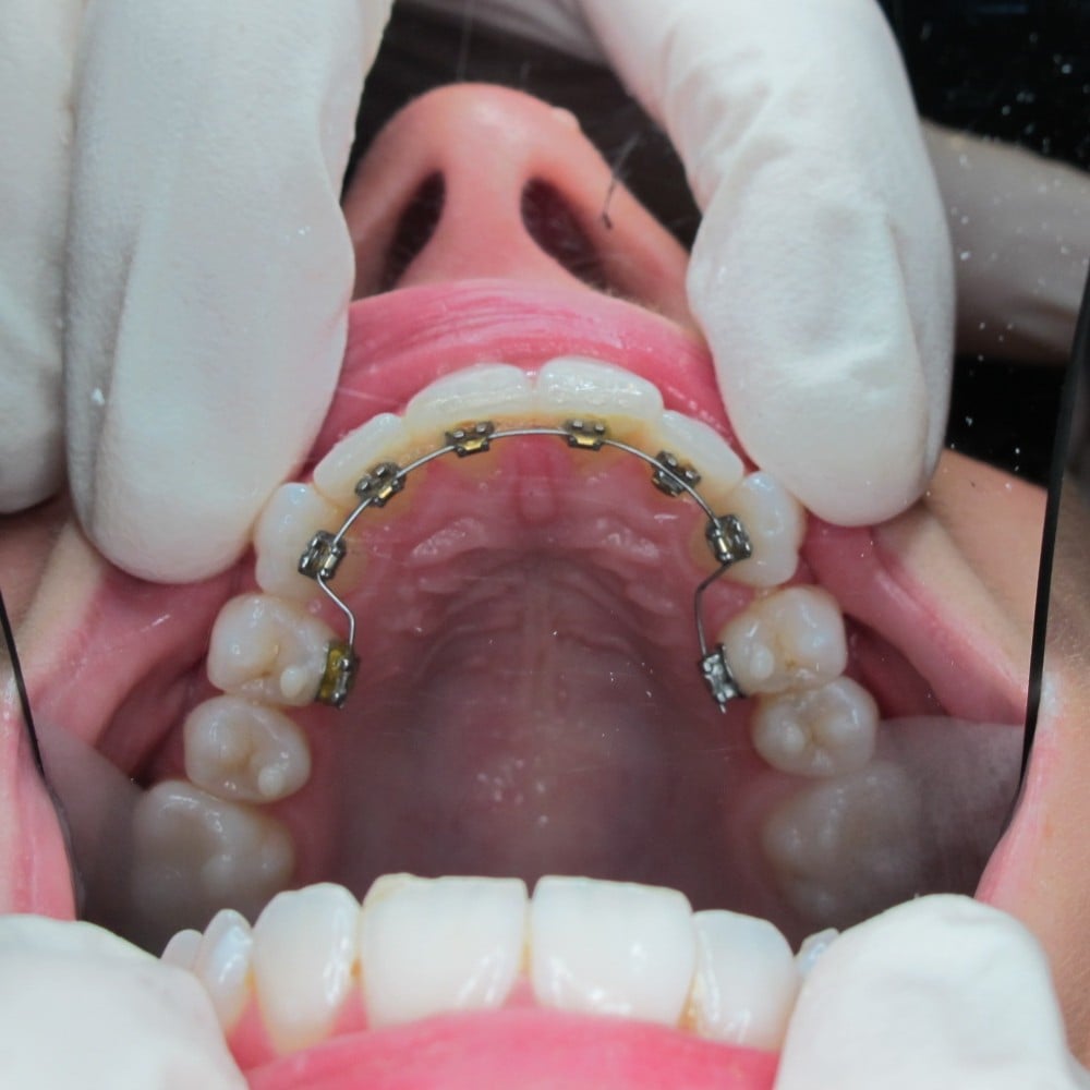 Amy After Treatment