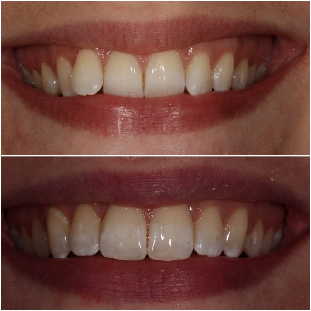 Success Stories Patient Testimonials | Dentistry @ No.3 & Century House