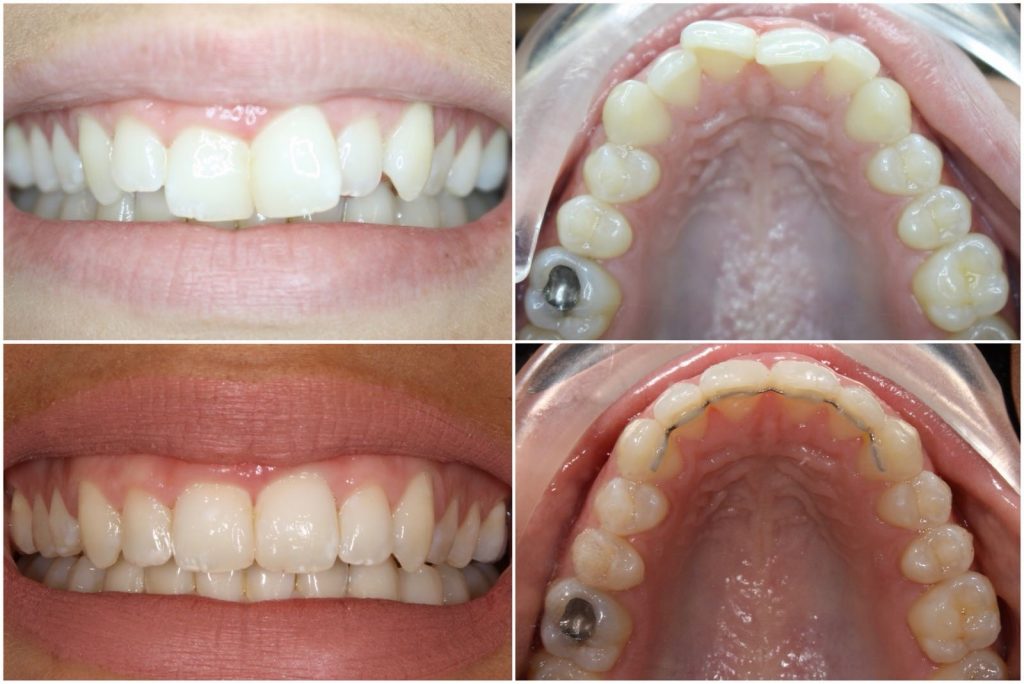 Success Stories Patient Testimonials | Dentistry @ No.3 & Century House