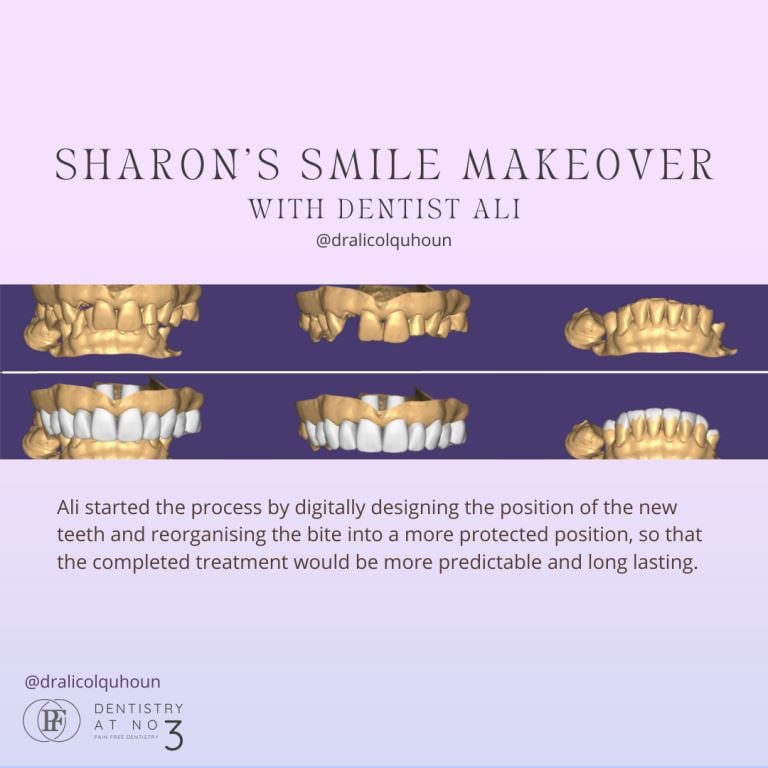 Smile Makeovers | Dentistry @ No.3 & Century House
