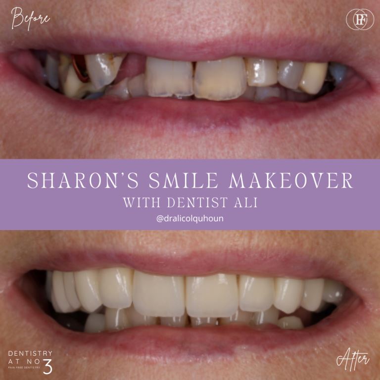 Smile Makeovers | Dentistry @ No.3 & Century House