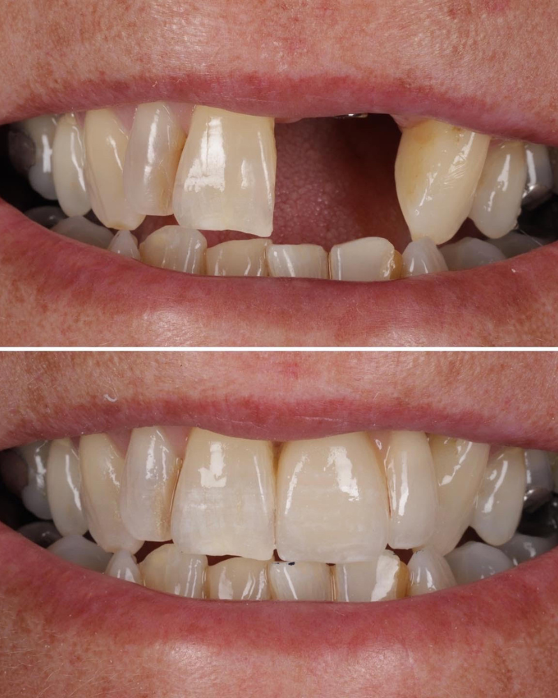 Before & after treatment with Alisdair