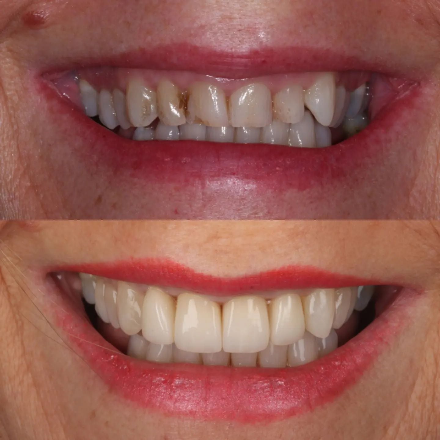 Rebecca Masterson | Dentistry @ No.3 & Century House Before & after treatment with Rebecca