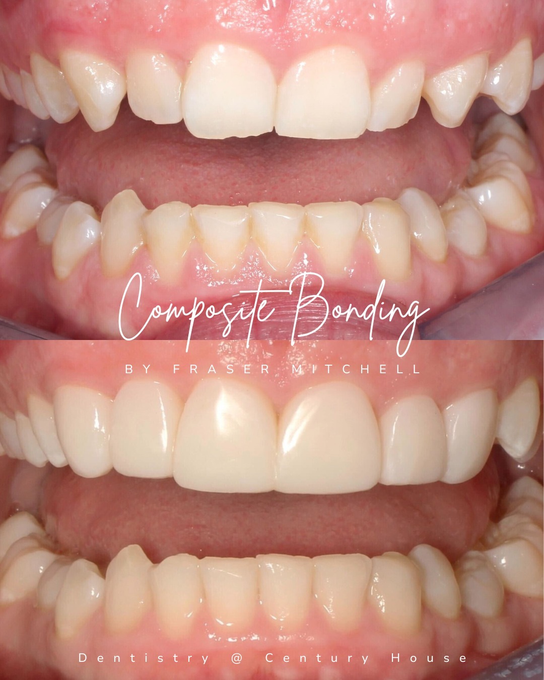 Before and after treatment
