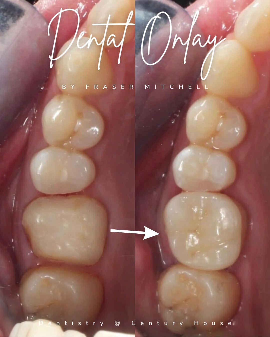 Before and after treatment