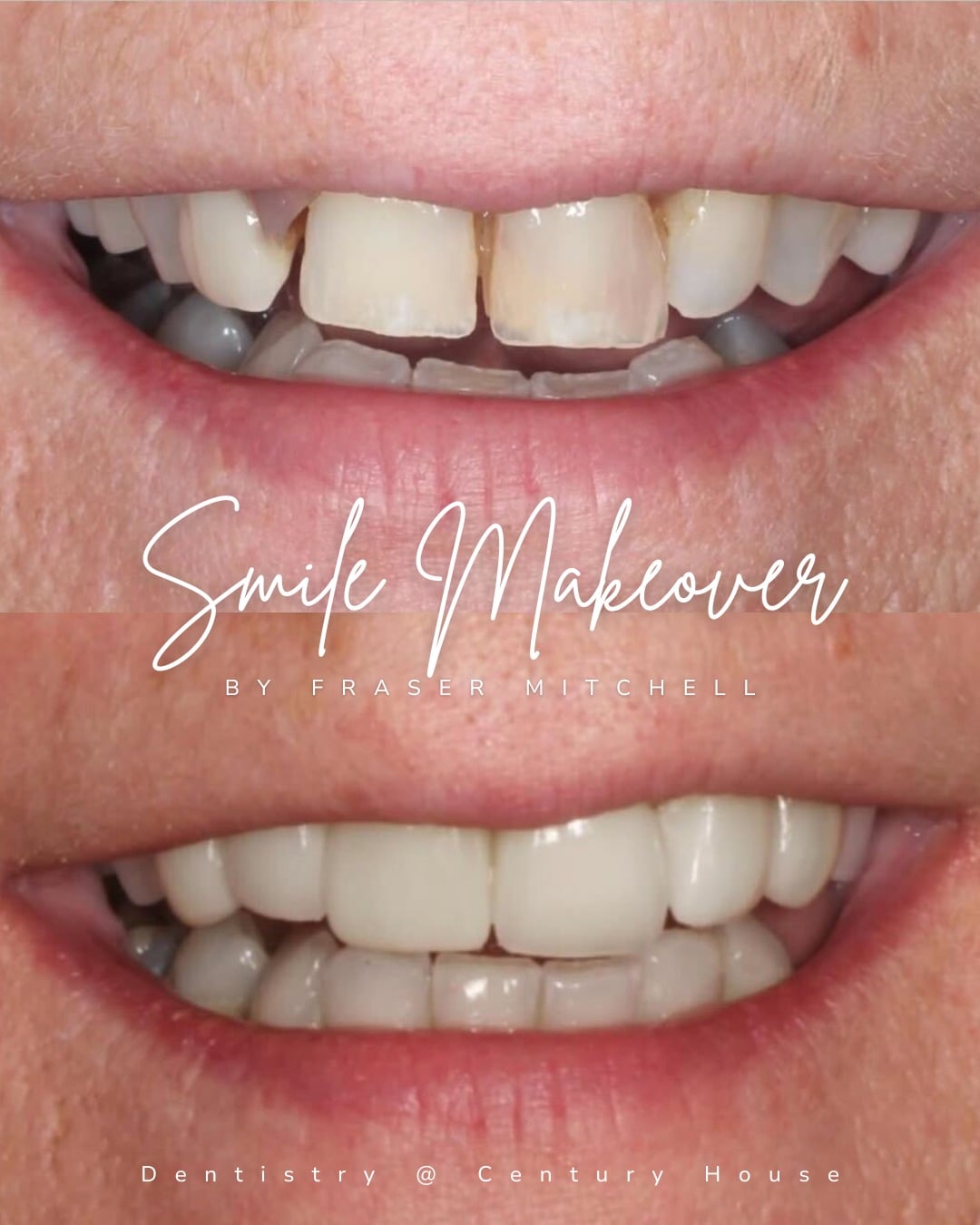 Before and after treatment