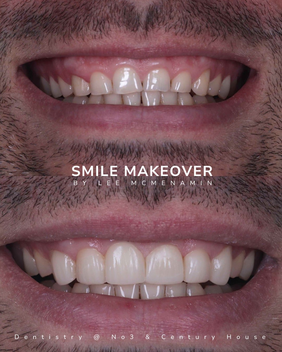 Before and after treatment