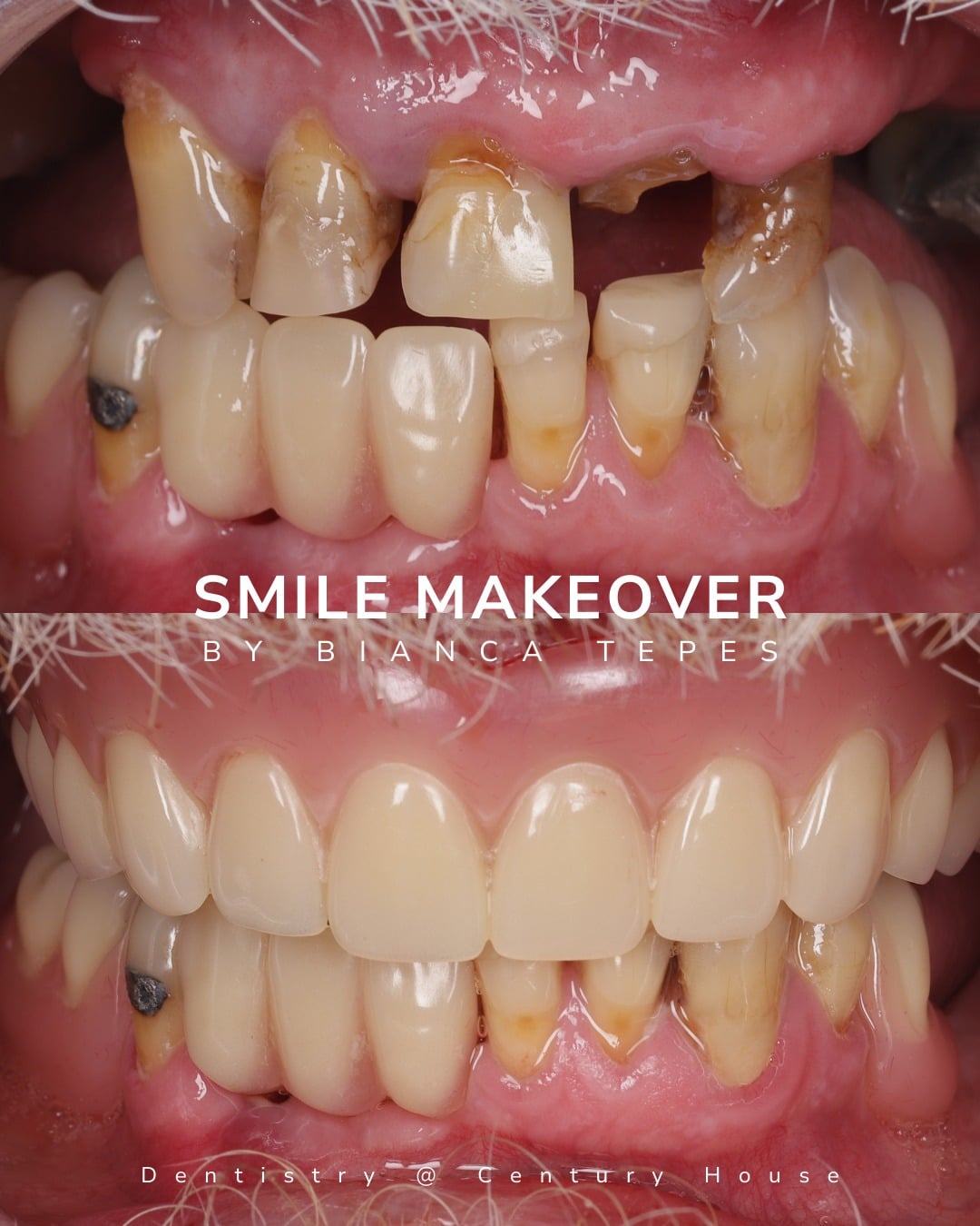 Before and after treatment