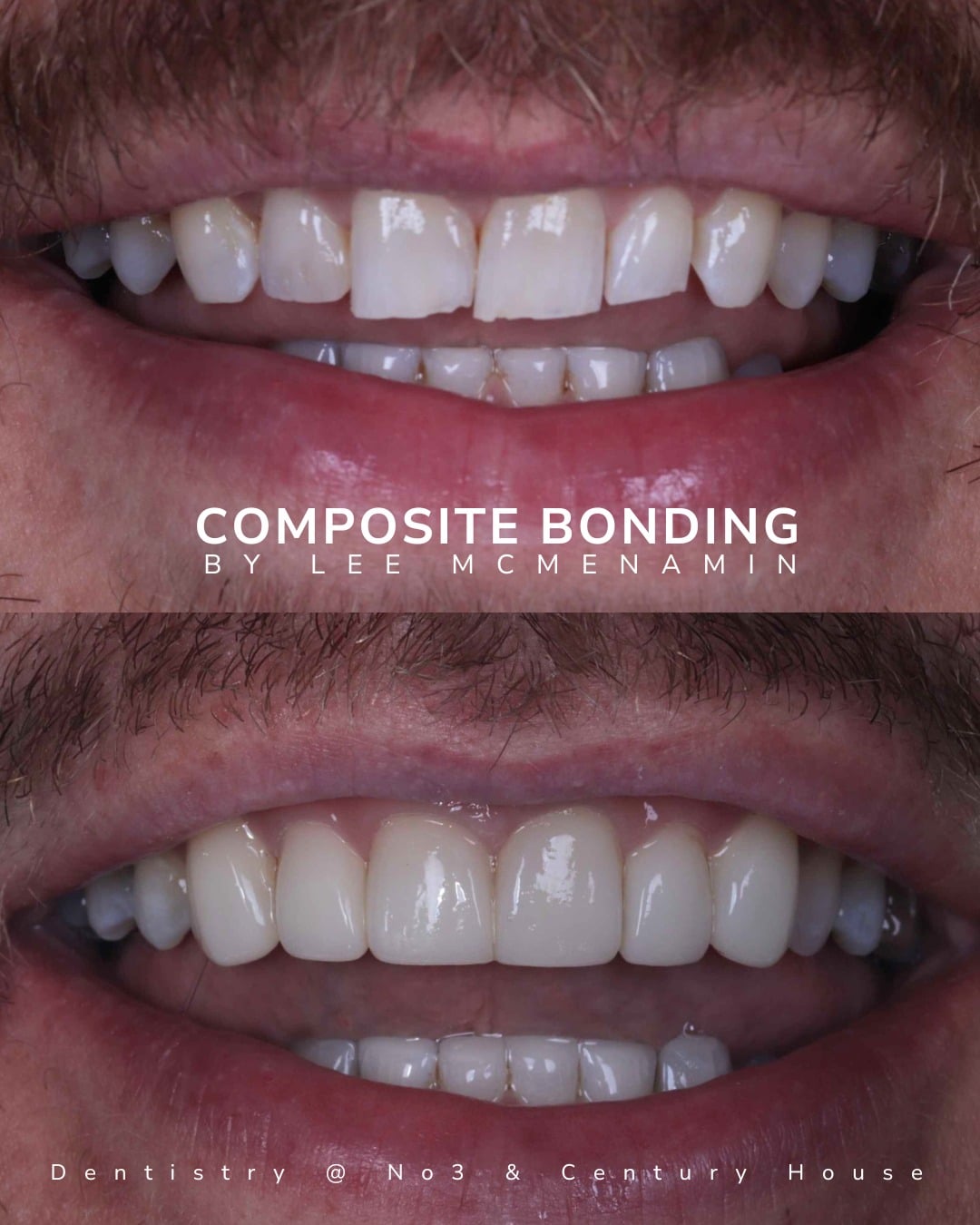 Before and after treatment