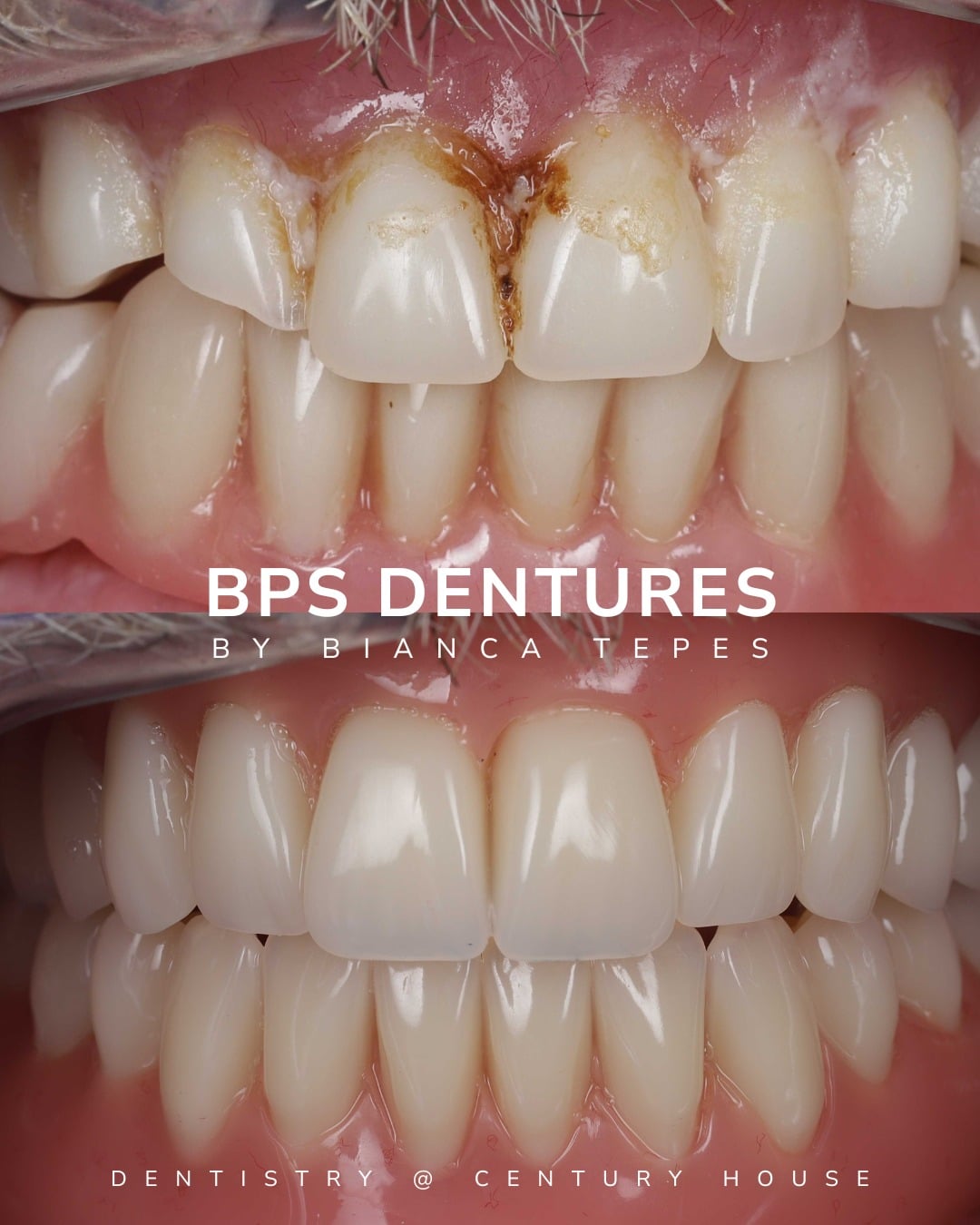 Before and after treatment