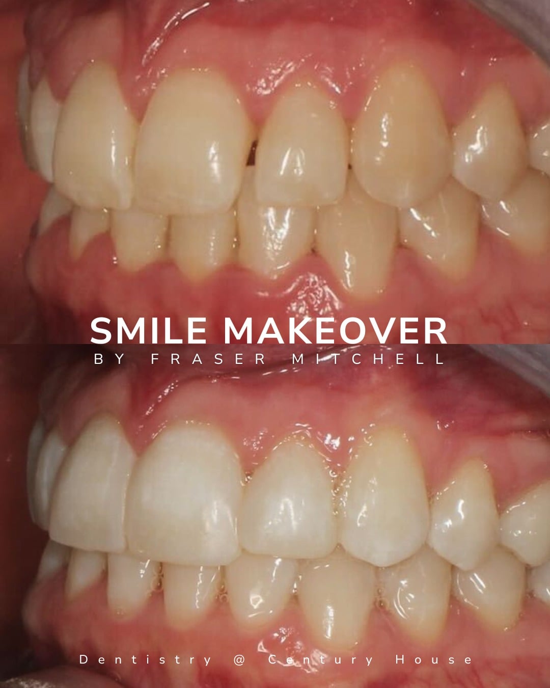 Before and after treatment