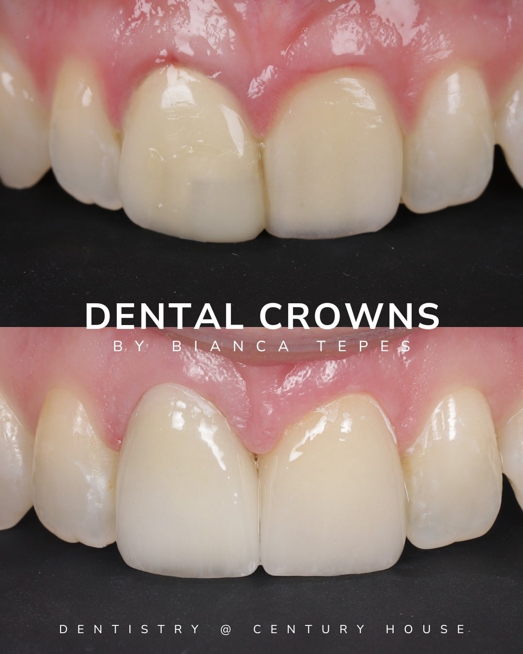 Before and after treatment
