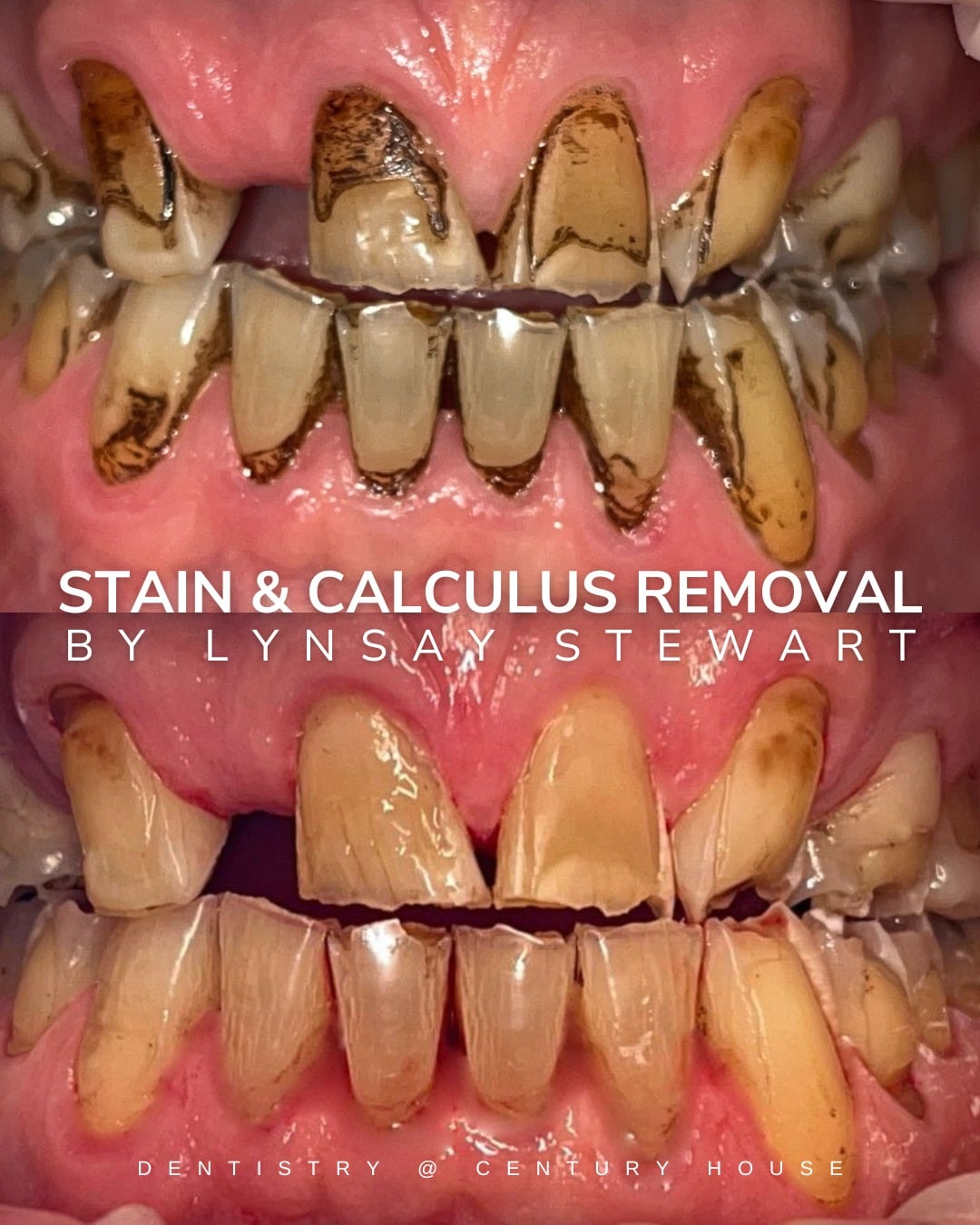 Before and after treatment