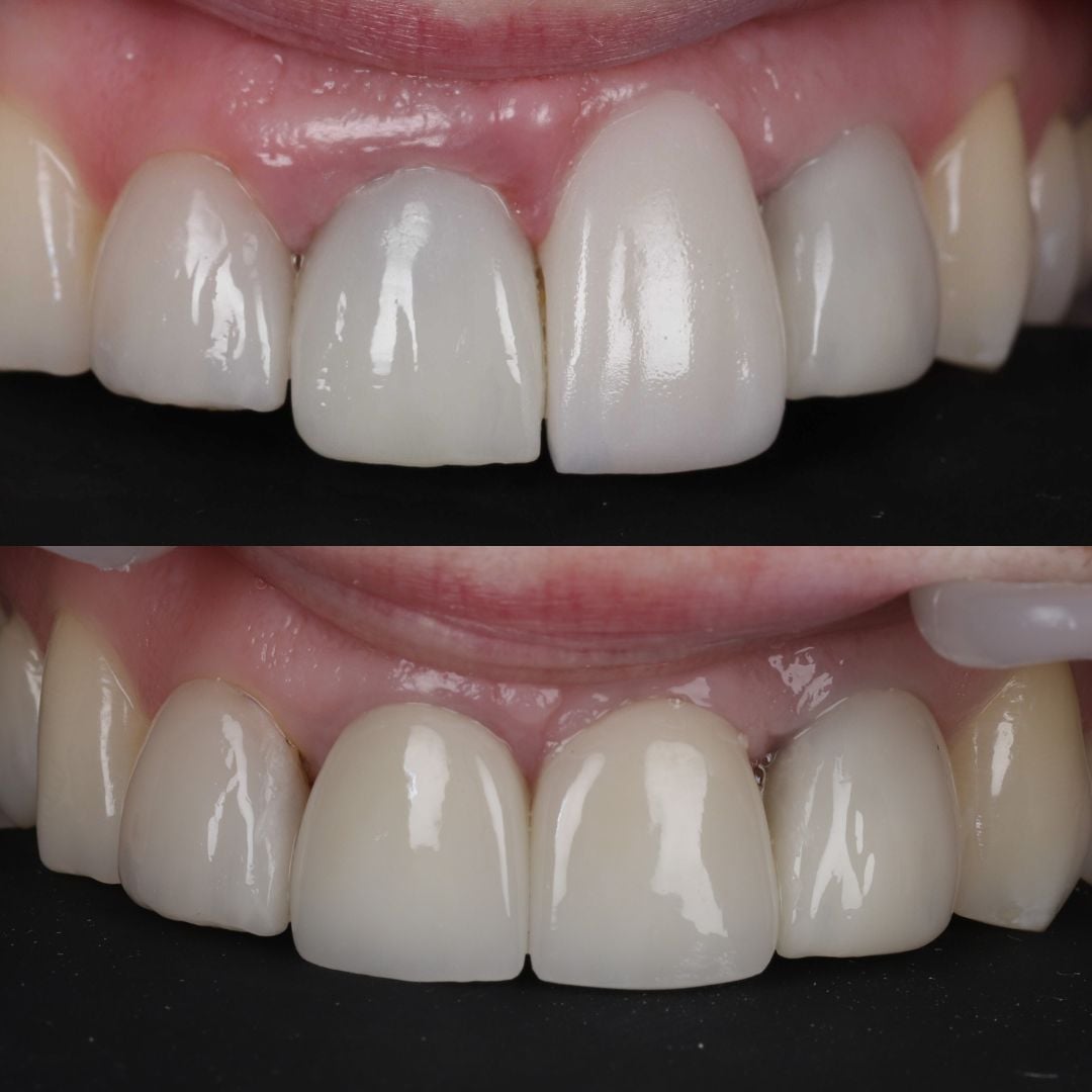 Dr Bianca Tepes | Dentistry @ No.3 & Century House