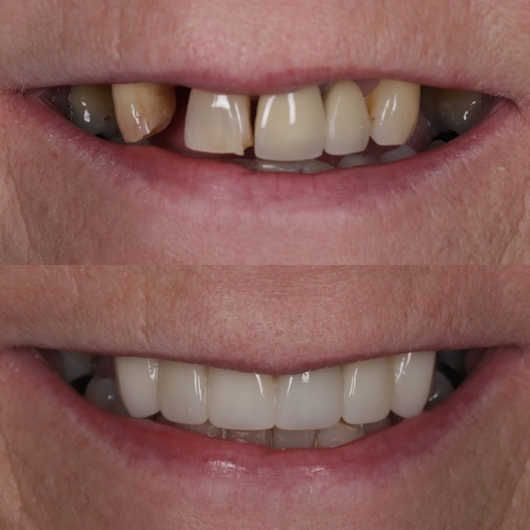 Dr Bianca Tepes | Dentistry @ No.3 & Century House
