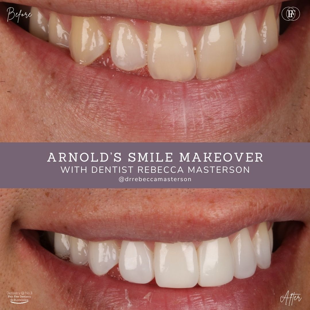 Arnold’s Smile Story | Dentistry @ No.3 & Century House