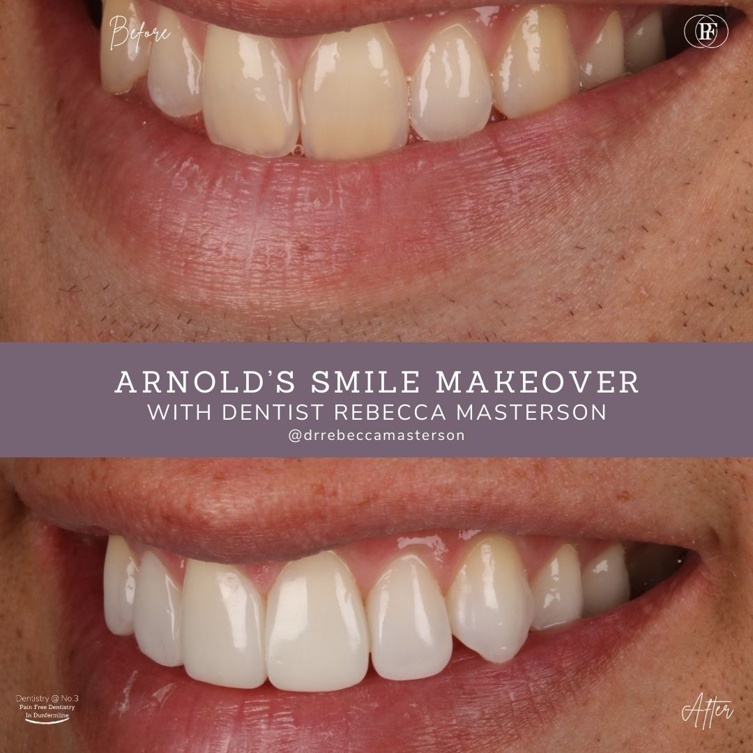 Arnold’s Smile Story | Dentistry @ No.3 & Century House