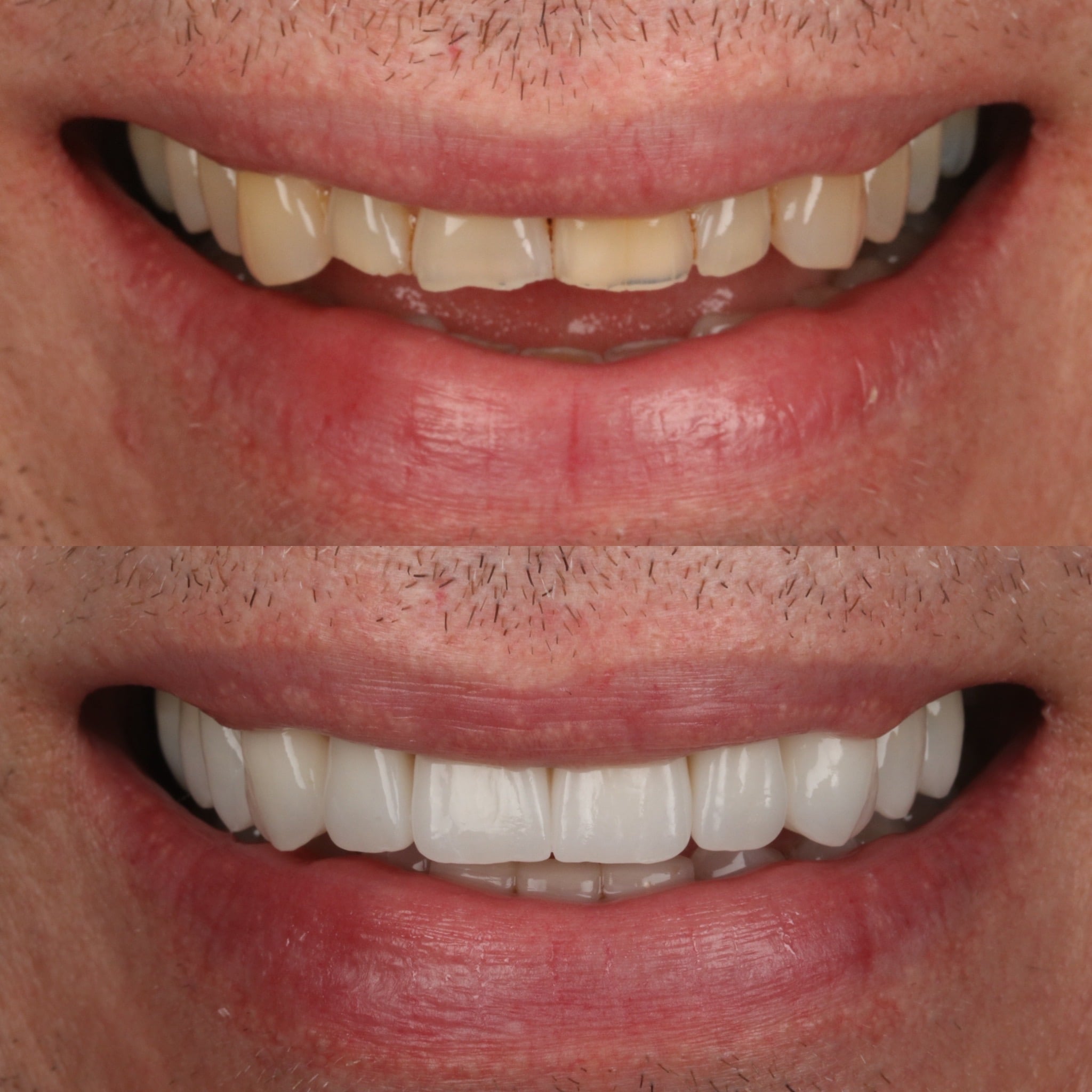 Request A Complimentary Consultation | Dentistry @ No.3 & Century House Before and after treatment at Dentistry @ No.3 in Dunfermline