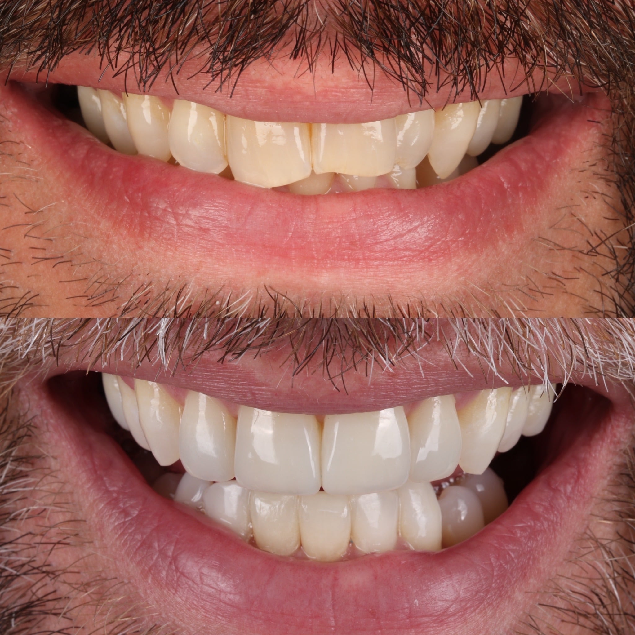 Request A Complimentary Consultation | Dentistry @ No.3 & Century House Before and after treatment at Dentistry @ No.3 in Dunfermline
