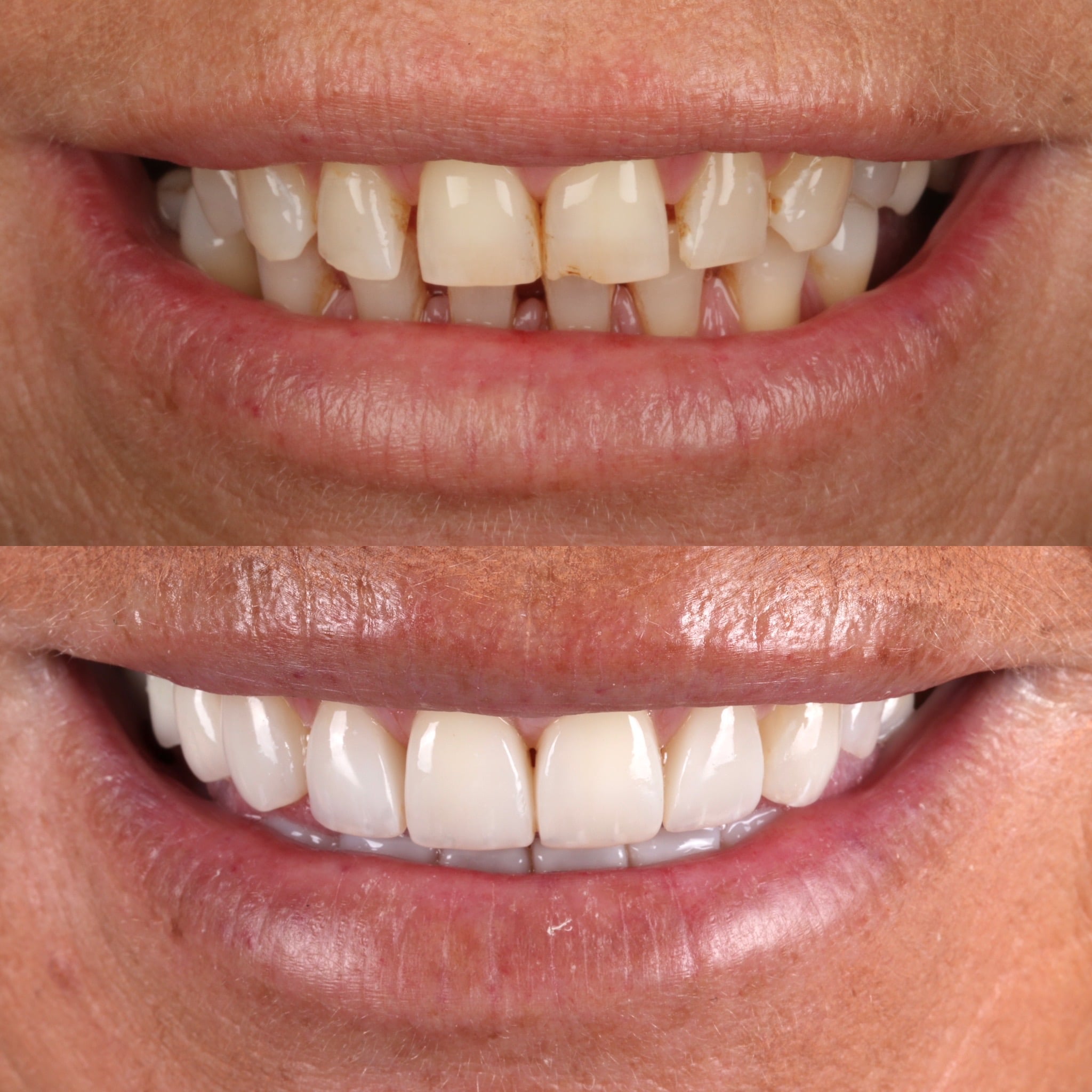 Request A Complimentary Consultation | Dentistry @ No.3 & Century House Before and after treatment at Dentistry @ No.3 in Dunfermline