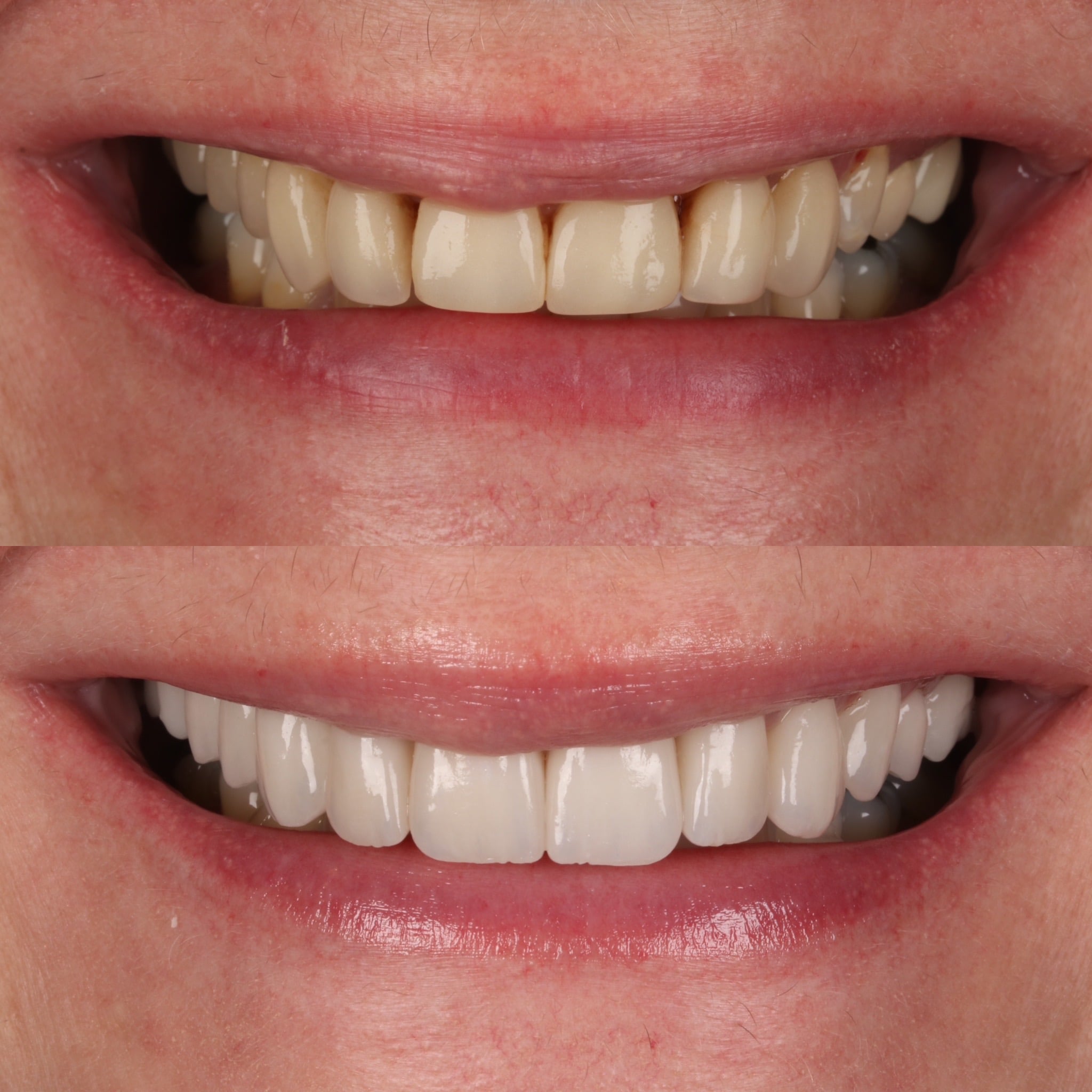 Request A Complimentary Consultation | Dentistry @ No.3 & Century House Before and after treatment at Dentistry @ No.3 in Dunfermline