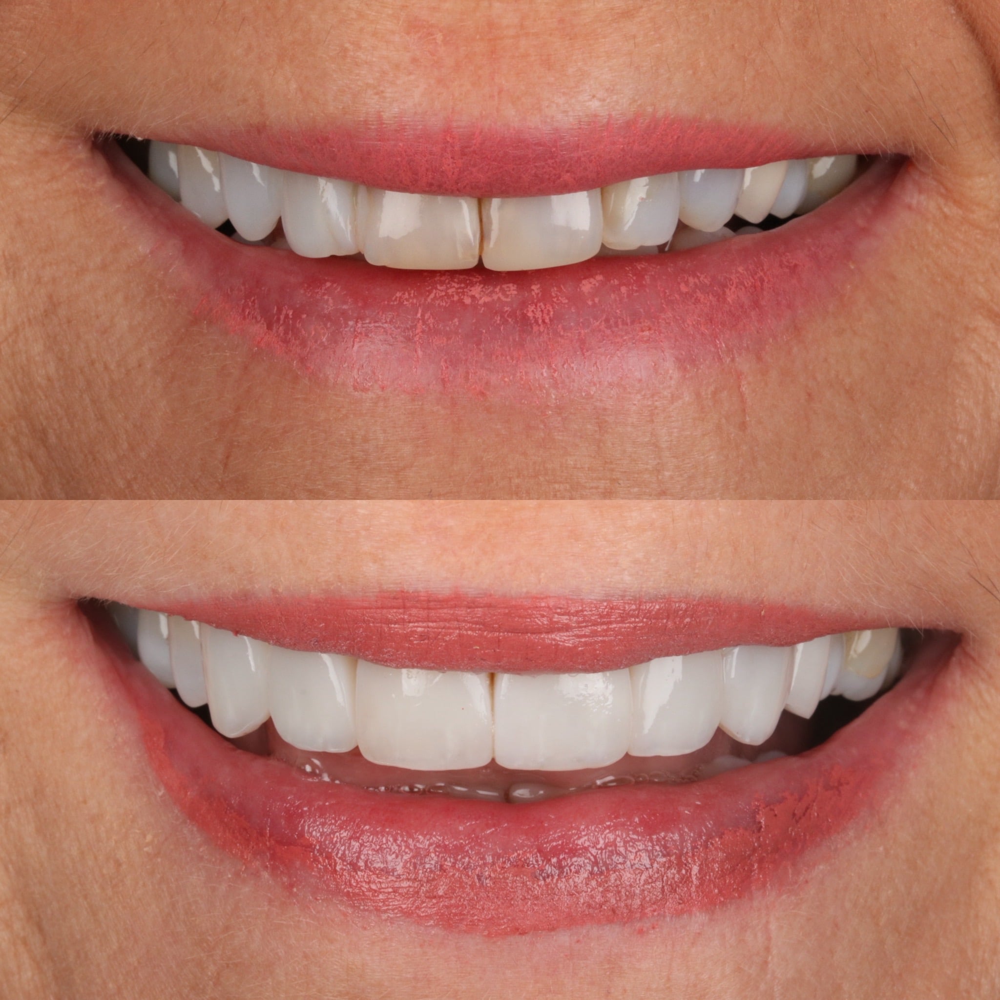 Request A Complimentary Consultation | Dentistry @ No.3 & Century House Before and after treatment at Dentistry @ No.3 in Dunfermline