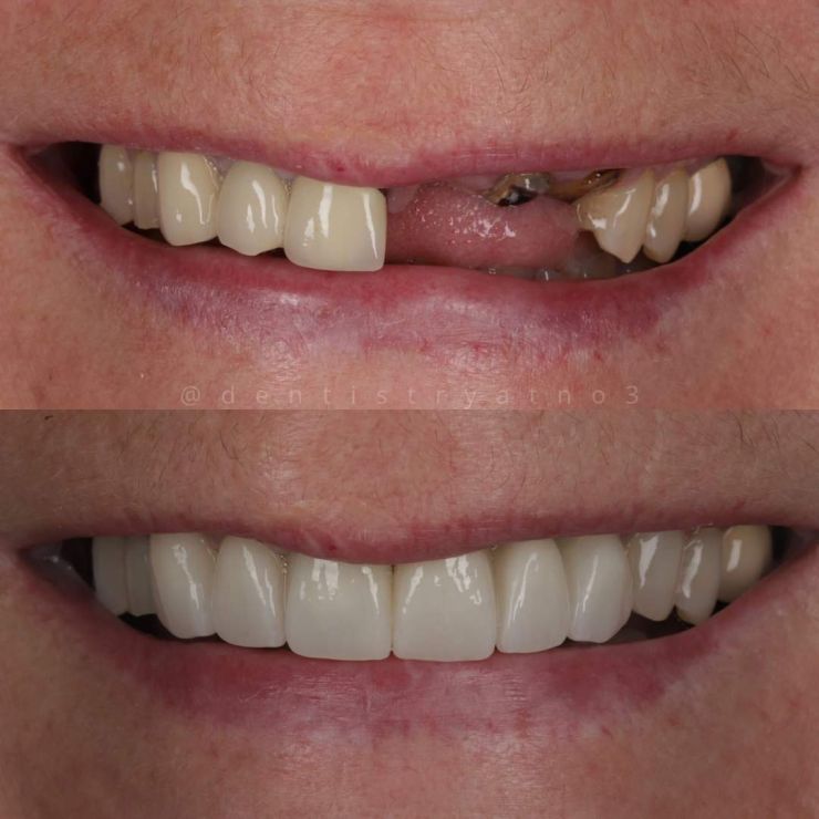 Transforming Smiles