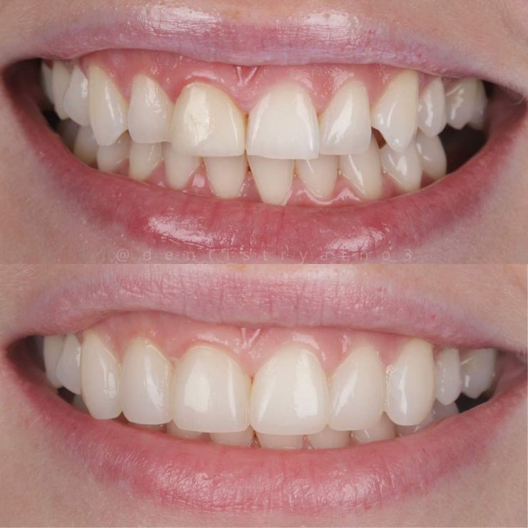 Transforming Smiles