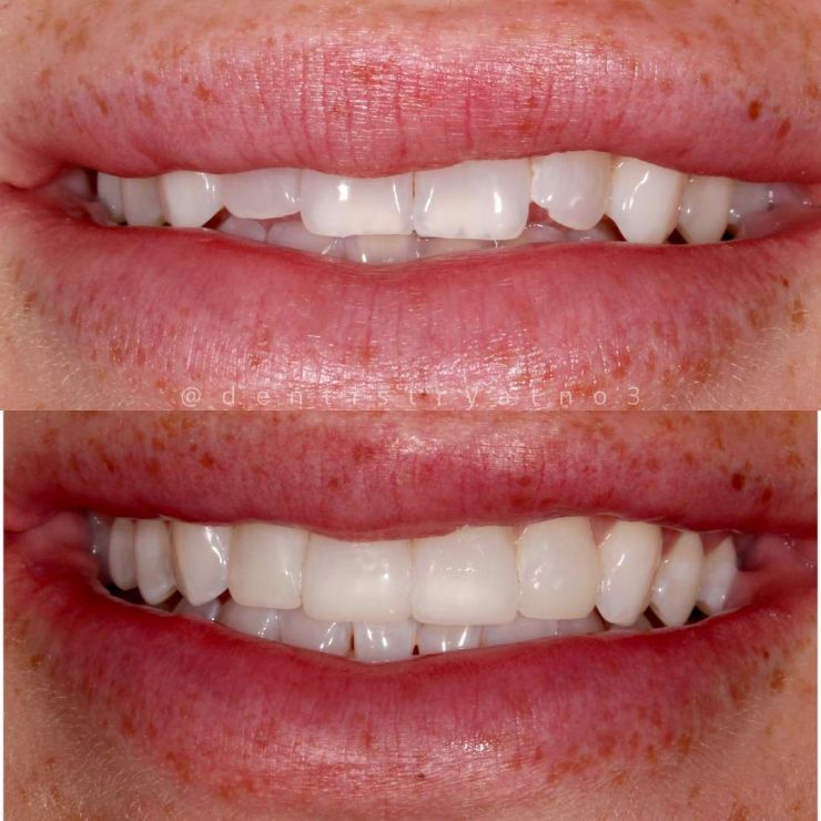Transforming Smiles