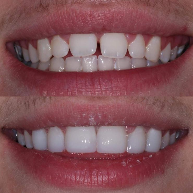 Transforming Smiles