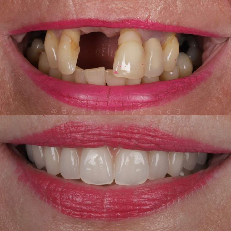 Transforming Smiles
