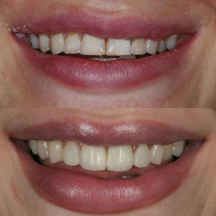 Transforming Smiles