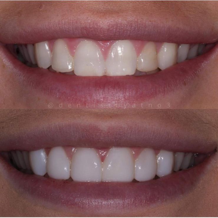 Transforming Smiles