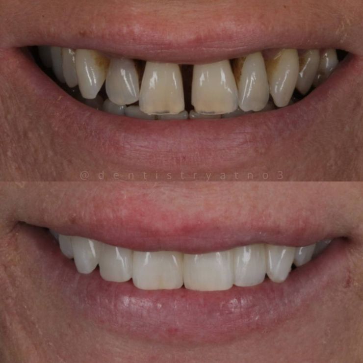 Transforming Smiles