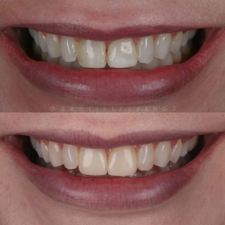 Transforming Smiles