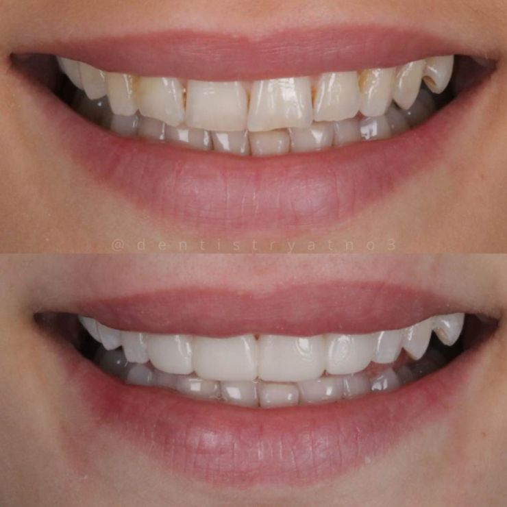 Transforming Smiles
