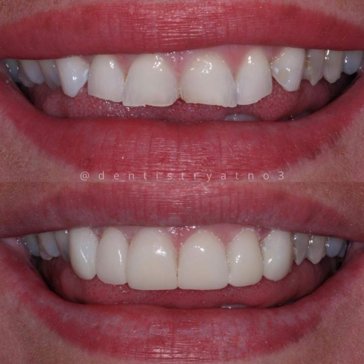 Transforming Smiles