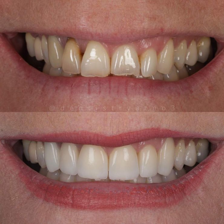 Transforming Smiles