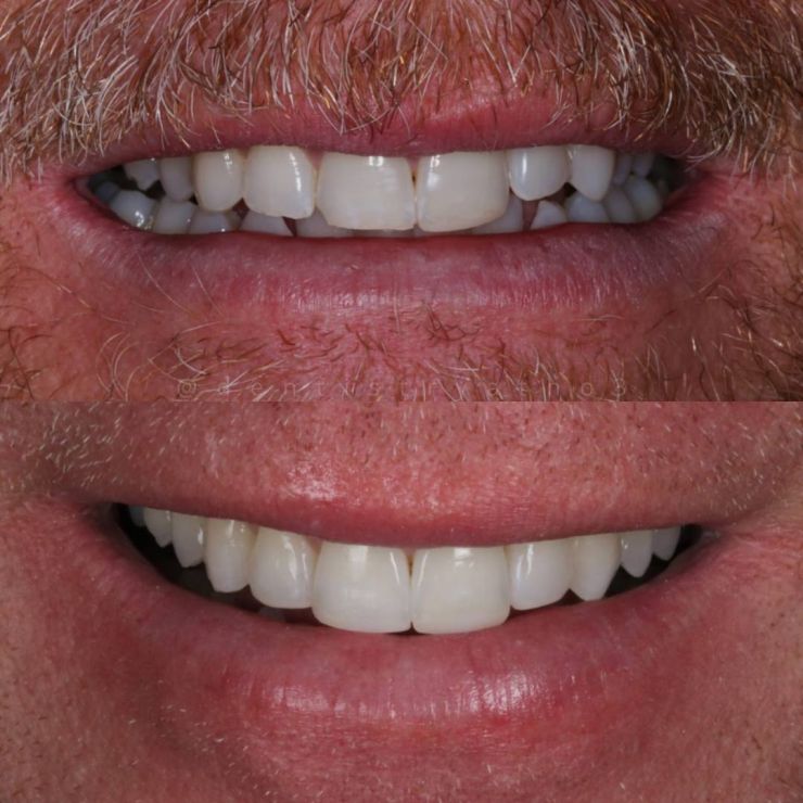 Transforming Smiles