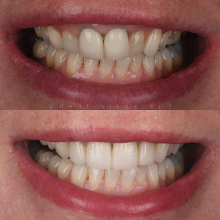 Transforming Smiles