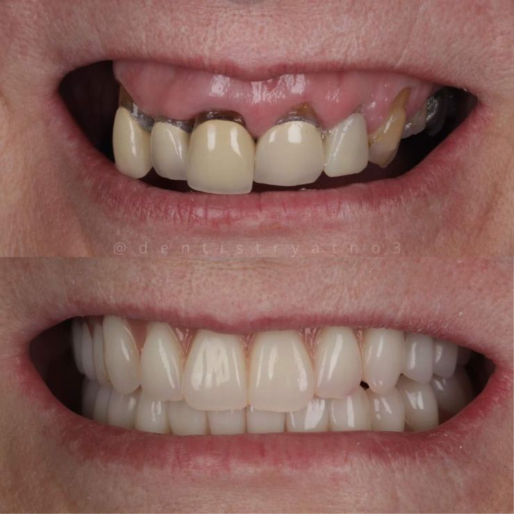 Transforming Smiles