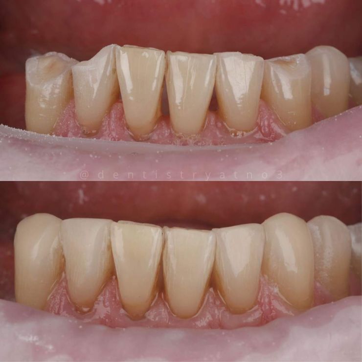 Transforming Smiles